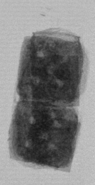 X-ray image showing product-in-seal evidence for package integrity review.