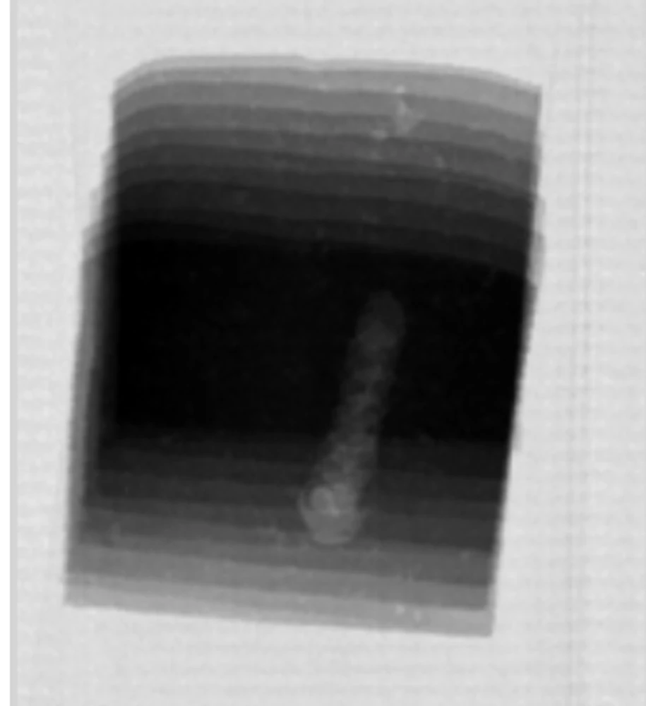 X-ray image showing internal voids in a cheese product